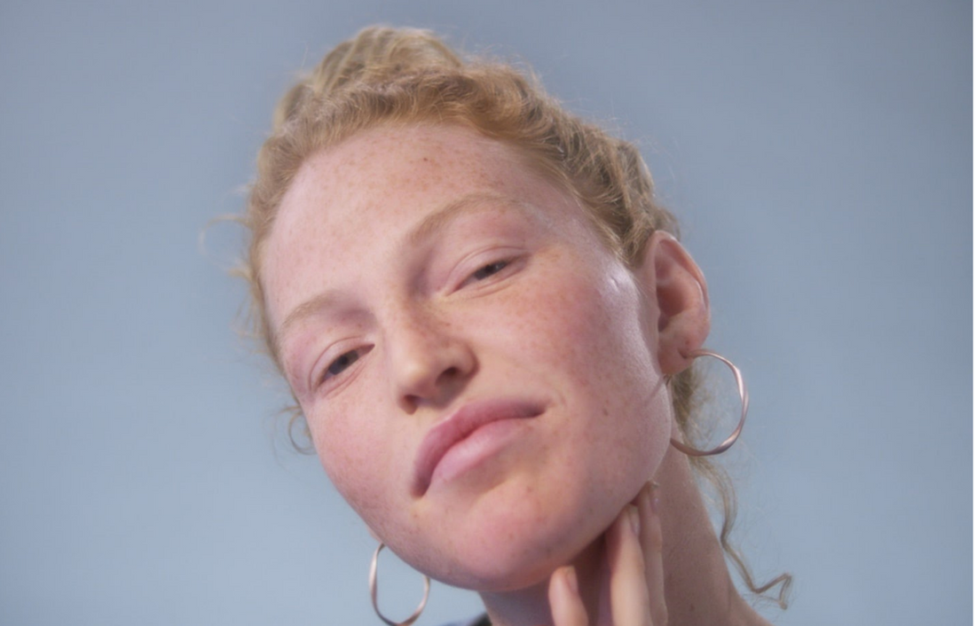 remove dark spots caused by pimples
